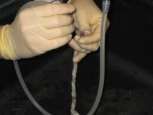 Umbilical Cord